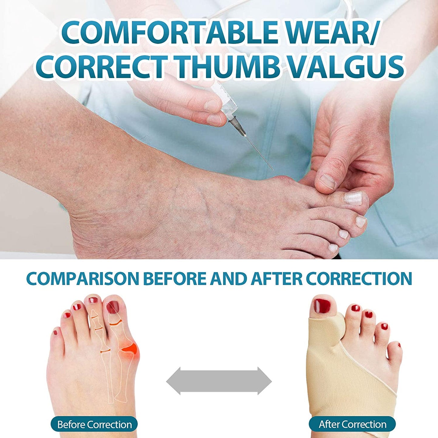 Hallux Valgus Treatment Big Toe Separators/Bunion Corrector